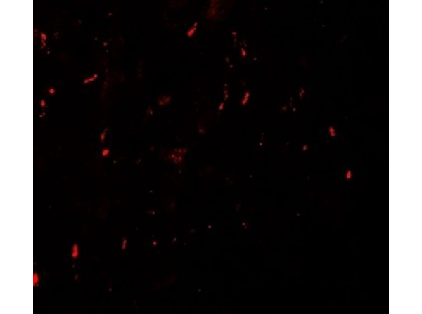 Immunofluorescence of MYT1L