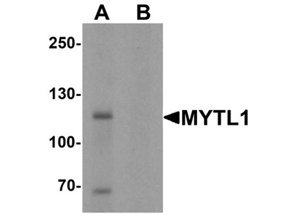 Western blot analysis of MYT1L