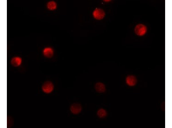 Immunofluorescence of N4BP1