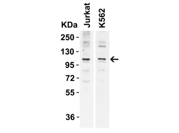 WB Validation of N4BP1