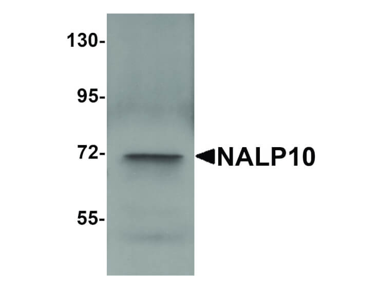 Western Blot of NALP10 Antibody