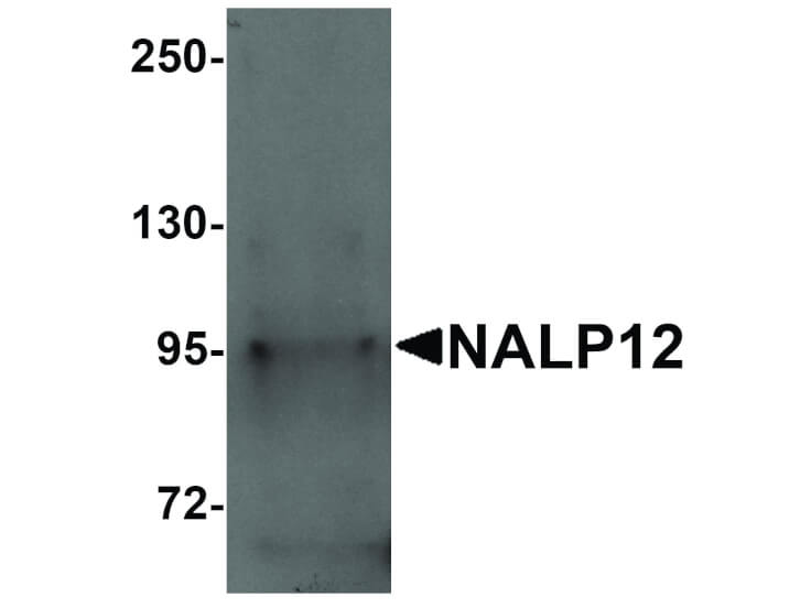 Western Blot of NALP12 Antibody