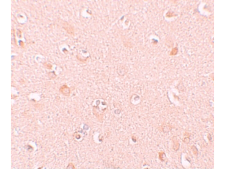 Immunohistochemistry of NALP5 Antibody