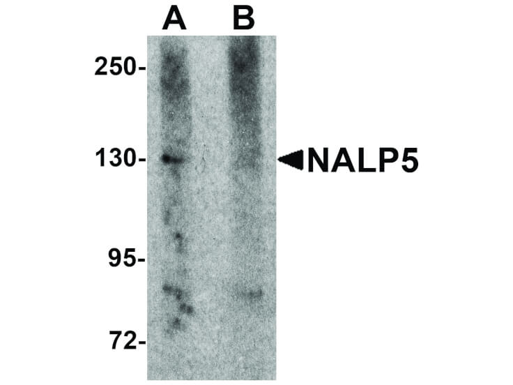 Western Blot of NALP5 Antibody