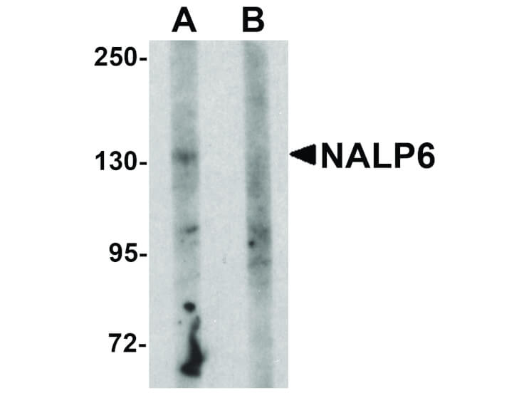 Western Blot of NALP6 Antibody