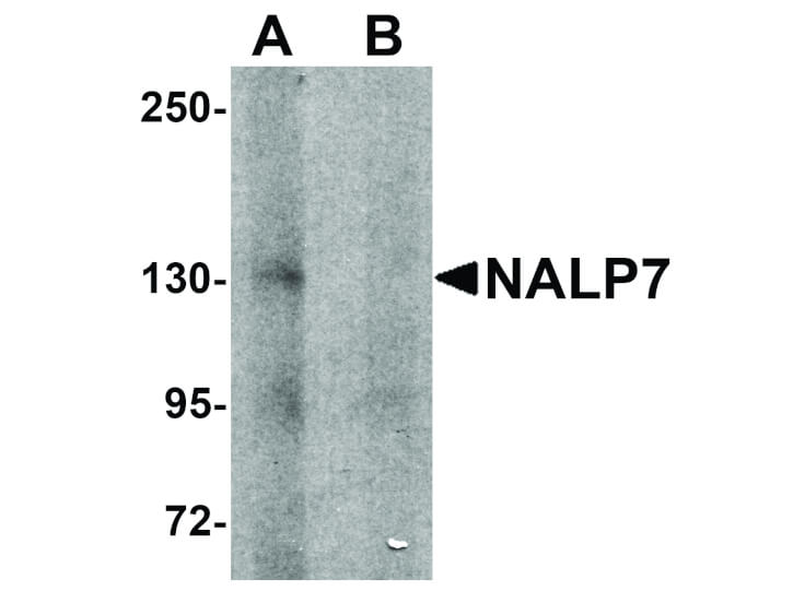 Western Blot of NALP7 Antibody