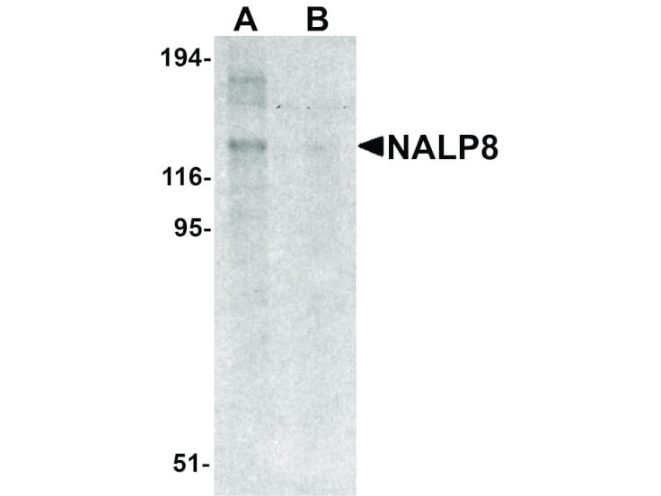 Western Blot of NALP8 Antibody