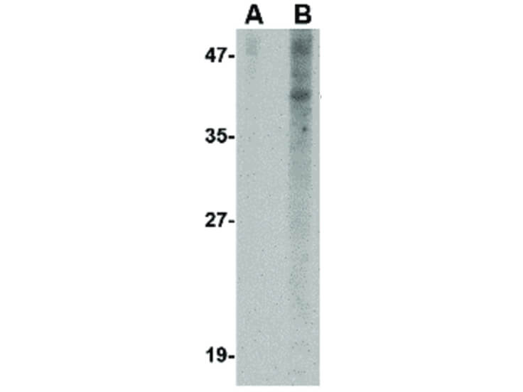 Western Blot of Nanos1 Antibody