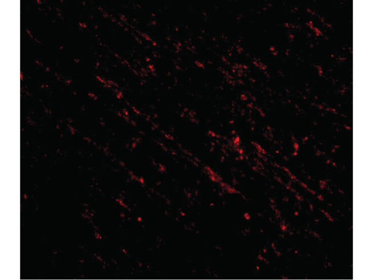 Immunofluorescence of Nanos1 Antibody