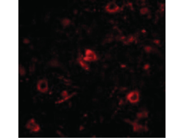 Immunofluorescence of Nanos3 Antibody