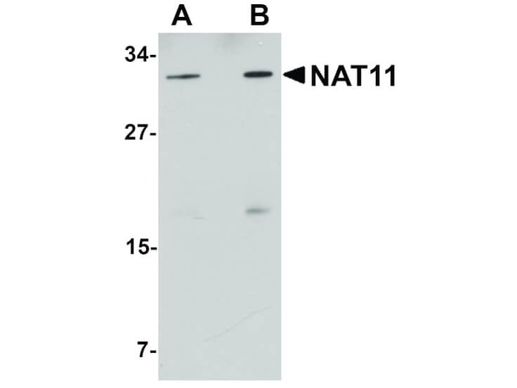 Western Blot of NAT11 Antibody