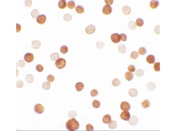 Immunocytochemistry of NCBP1
