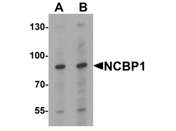 Western blot of NCBP1
