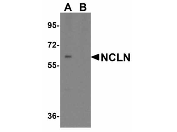 Western blot analysis of NCLN