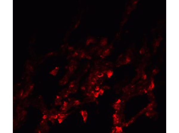 Immunofluorescence of NDFIP1