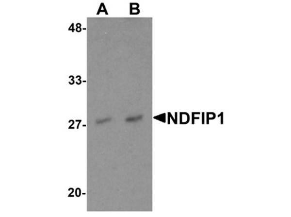 Western blot analysis of NDFIP1