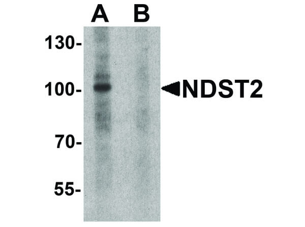 Western Blot of NDST2 Antibody