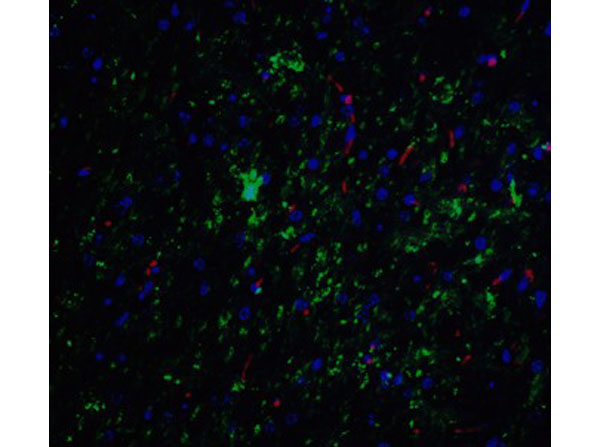 Immunofluorescence of NELF