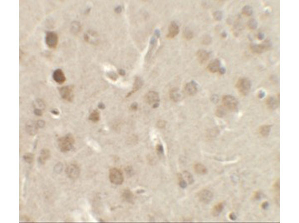 Immunohistochemistry of NELF