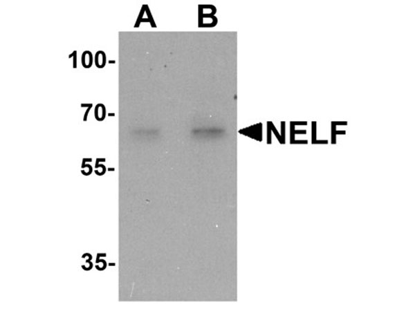 Western blot analysis of NELF