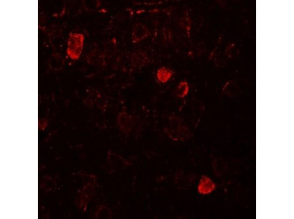 Immunofluorescence of NELF