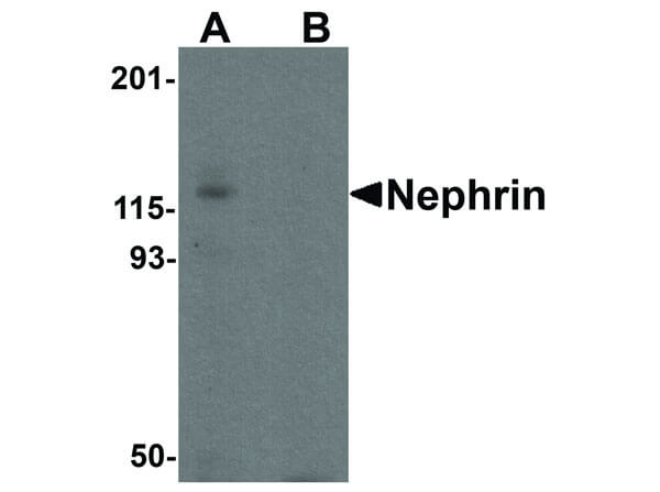 Western Blot of Nephrin Antibody