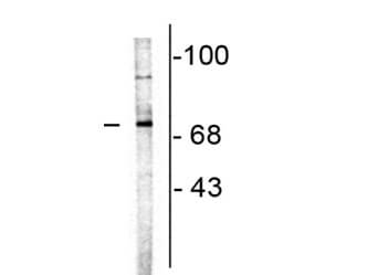 Western Blot of Anti-Choline Acetyltransferase Antibody