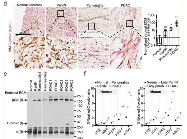 Immunohistochemistry using Collagen I alpha 1