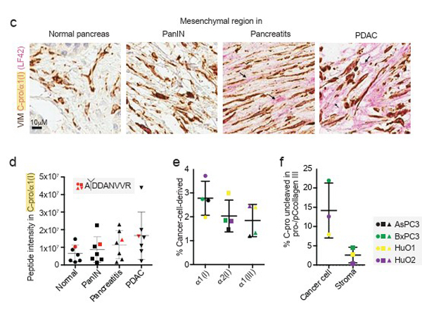 Immunohistochemistry using Collagen I alpha 1