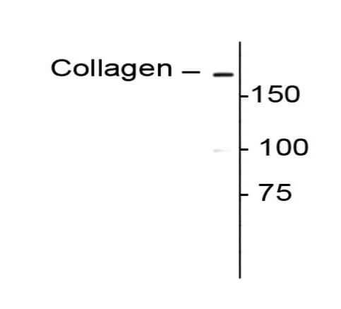 Western Blot of Rabbit anti-Collagen I alpha 1 propeptide antibody