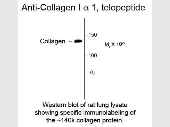 Collagen I alpha 1 telopeptide Antibody