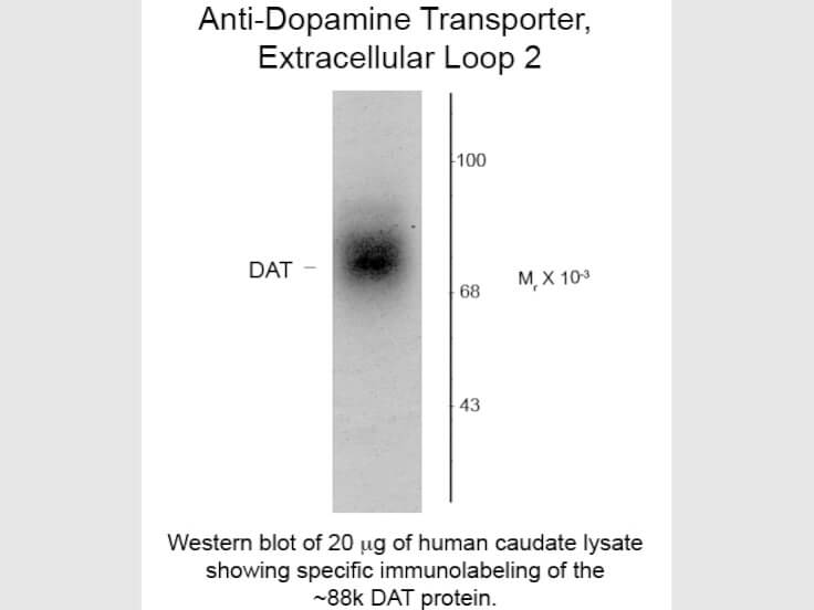 Western Blot of Anti-Dopamine Transporter (Rabbit) Antibody - 600-401-D30