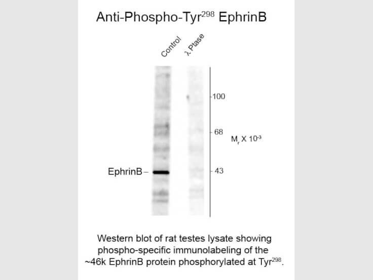 Western Blot of Anti-EphrinB pT298 (Rabbit) Antibody - 600-401-D35