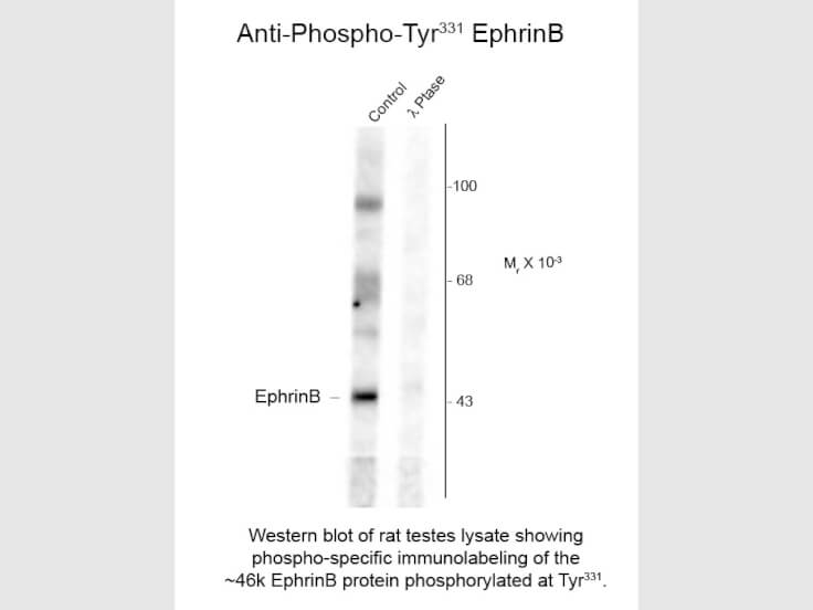 Western Blot of Anti-EphrinB pT331 (Rabbit) Antibody - 600-401-D37