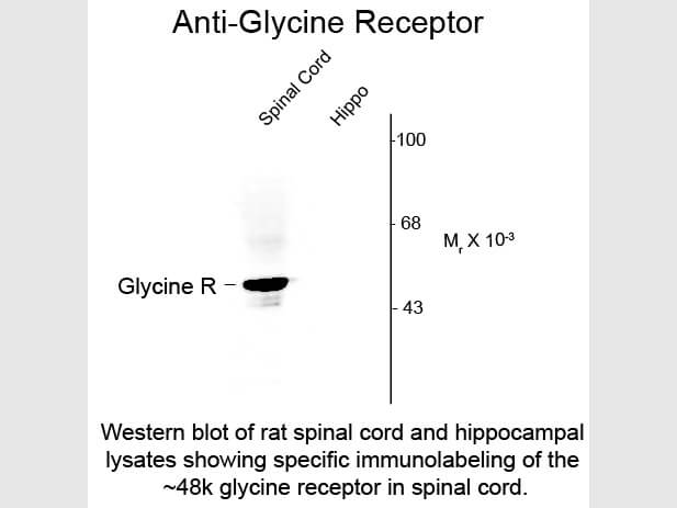 Western Blot of Anti-Glycine Receptor (Rabbit) Antibody - 600-401-D65