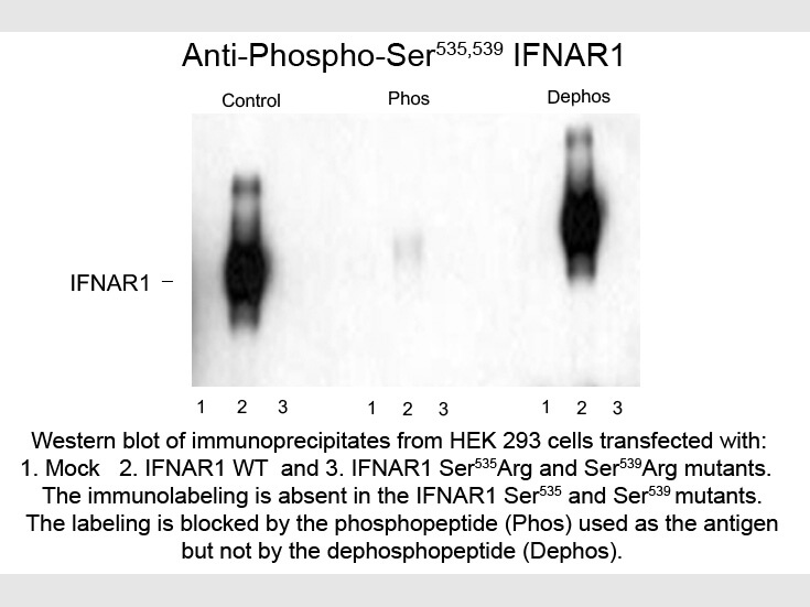 Western Blot of Anti-Interferon alpha Receptor Type I pS535/pS539 (Rabbit) Antibody - 600-401-D67