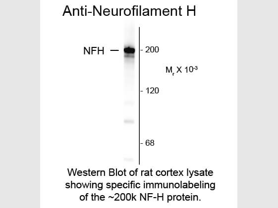 Western blot of Anti-Neurofilament H (Mouse) Antibody - 200-301-D82