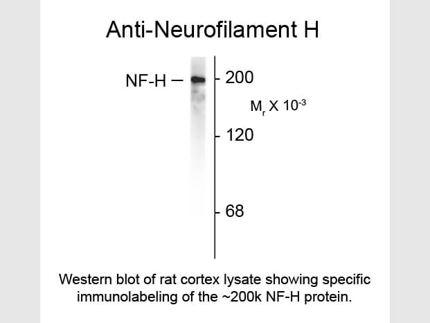 Western blot of Anti-Neurofilament H (Chicken) Antibody - 200-901-D82