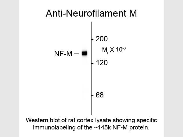 Western blot of Anti-Neurofilament M (Mouse) Antibody - 212-301-D84