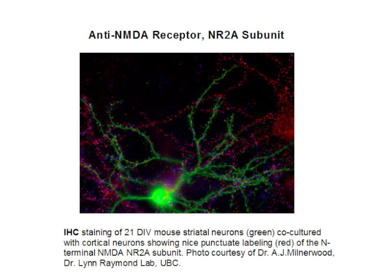 Immunohistochemical staining of Anti-NMDA R2A (Rabbit) Antibody - 612-401-D89