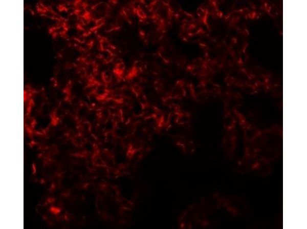 Immunofluorescence of NETO1