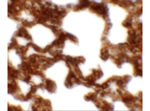 Immunohistochemistry of NETO1