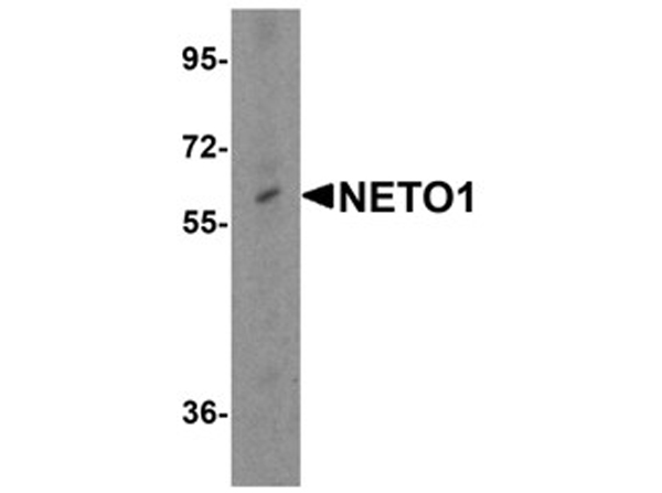 Western blot analysis of NETO1