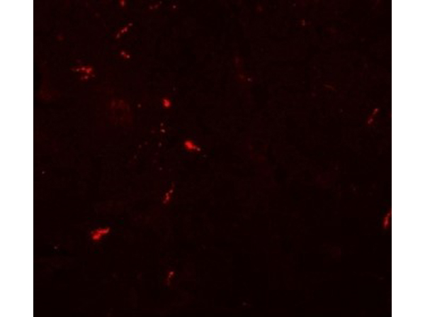 Immunofluorescence of NEUCRIN