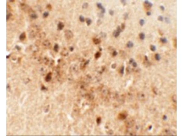 Immunohistochemistry of NEUCRIN