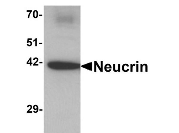 Western blot analysis of Neucrin
