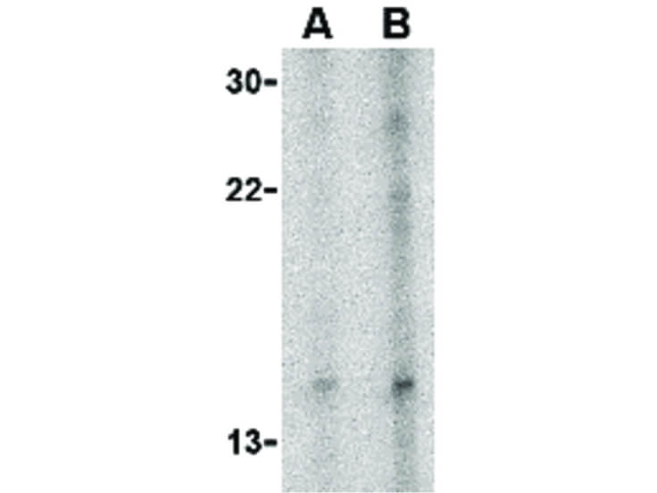 Western Blot of Neuritin Antibody