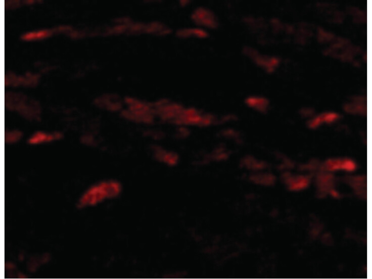 Immunofluorescence of Neuritin Antibody
