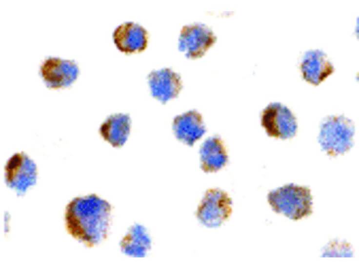Immunocytochemistry of NGFR Antibody