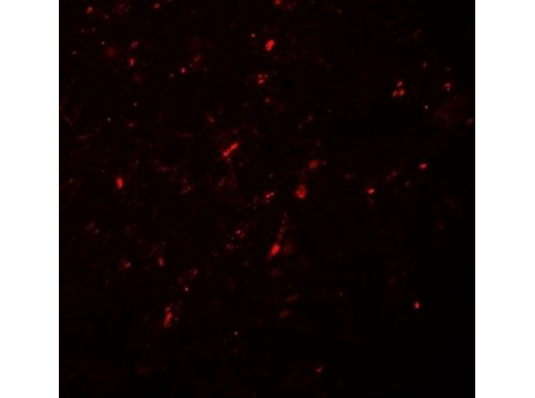 Immunofluorescence of NGN2